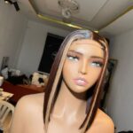 sdd birth mark bone straight